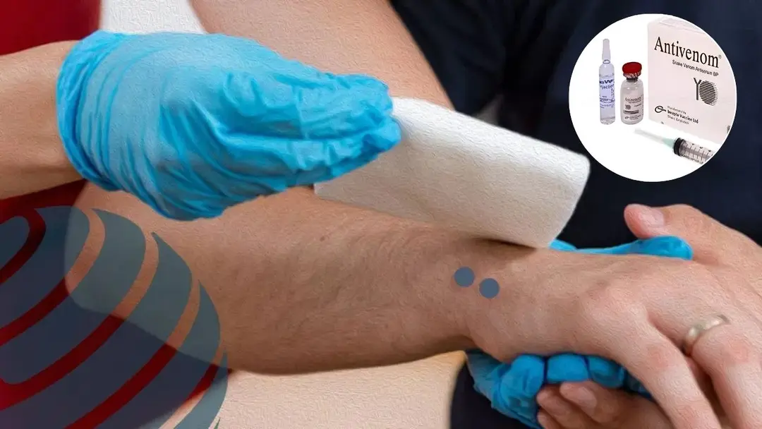 সাপে কাটে গ্রামে, অ্যান্টিভেনম থাকে শহরে; মৃত্যু হয় পথেই